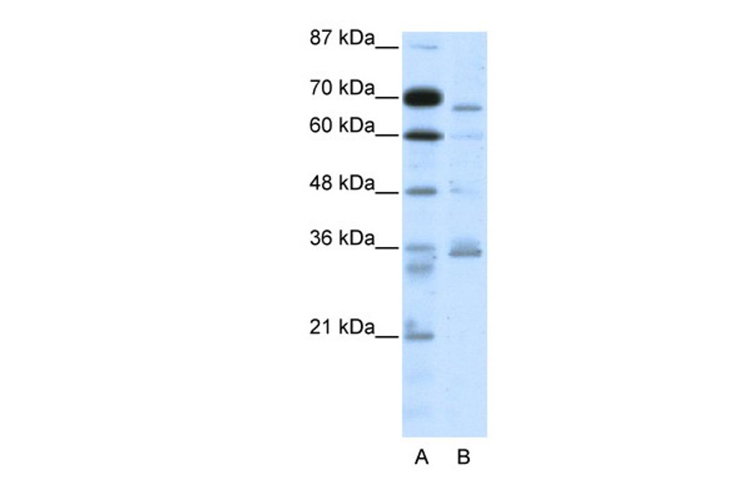 Antibody used in WB on Human HepG2 at 2.5 ug/ml.