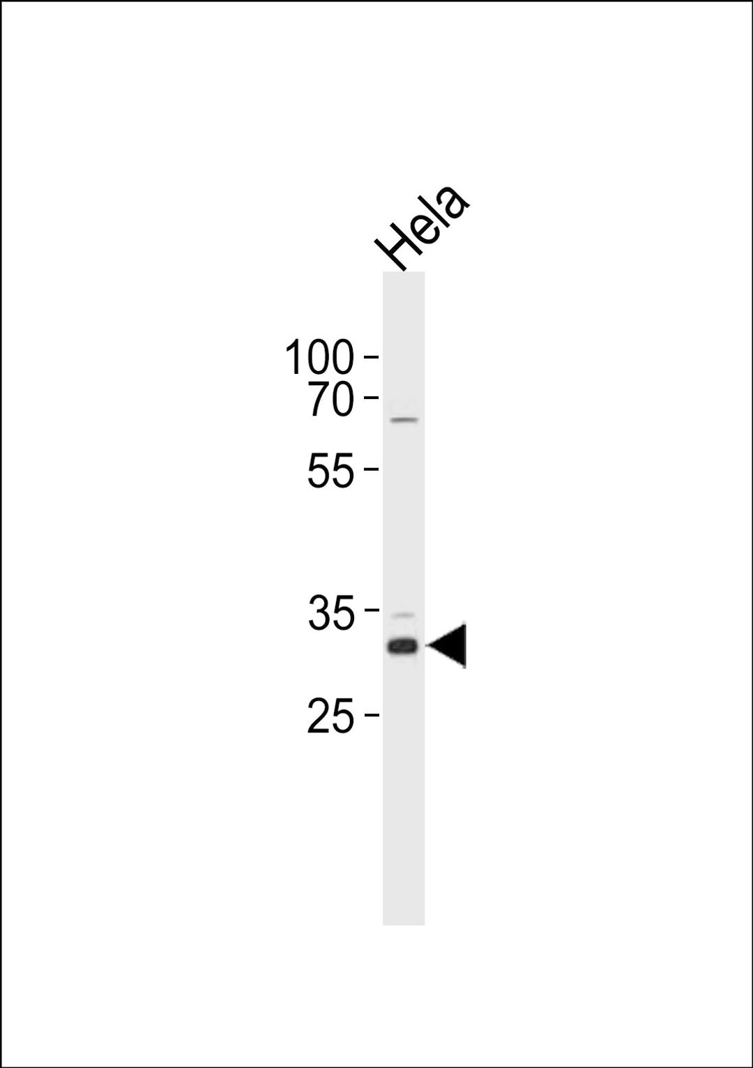 Western blot analysis in Hela cell line lysates (35ug/lane).