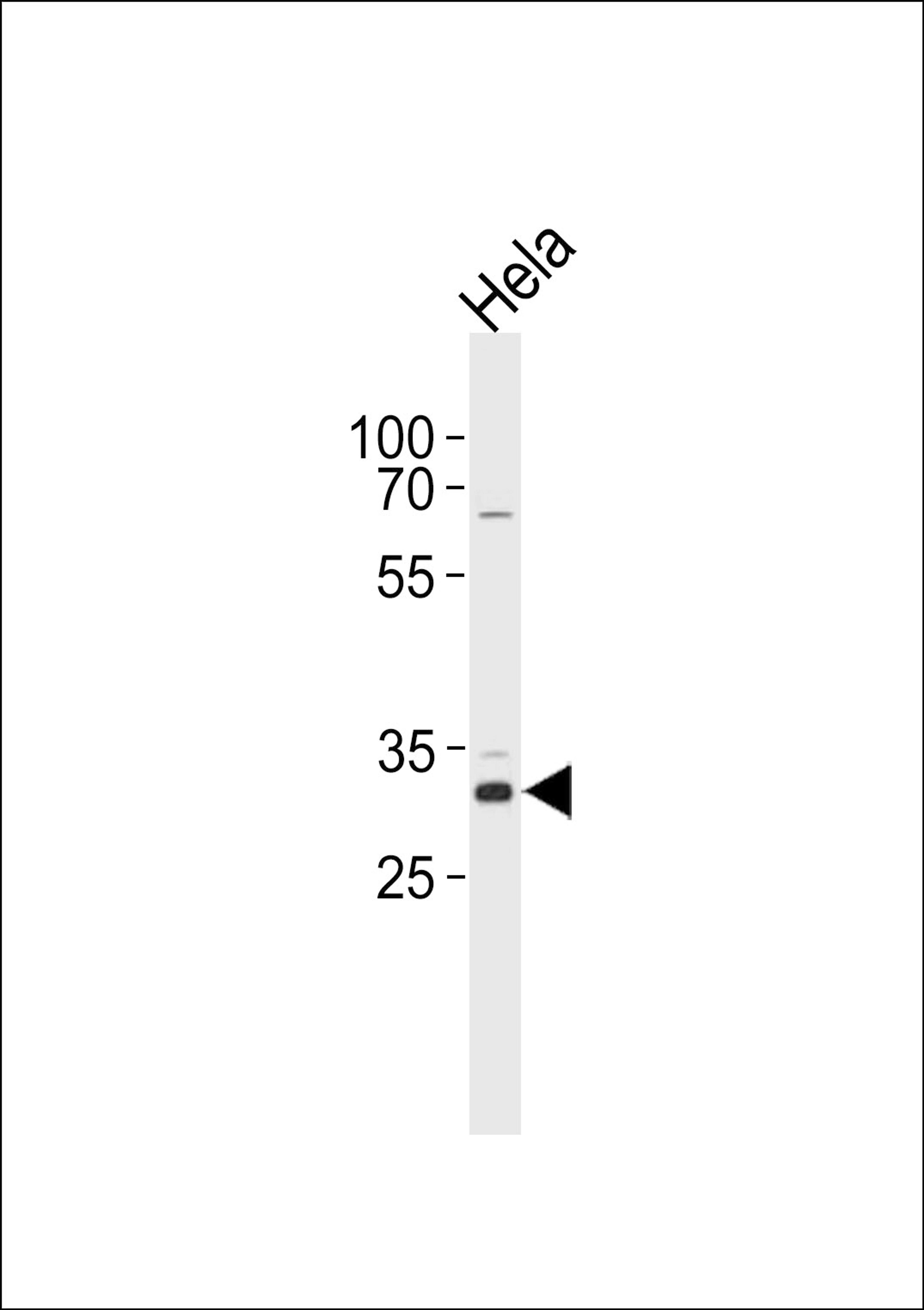 Western blot analysis in Hela cell line lysates (35ug/lane).