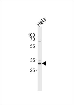 Western blot analysis in Hela cell line lysates (35ug/lane).