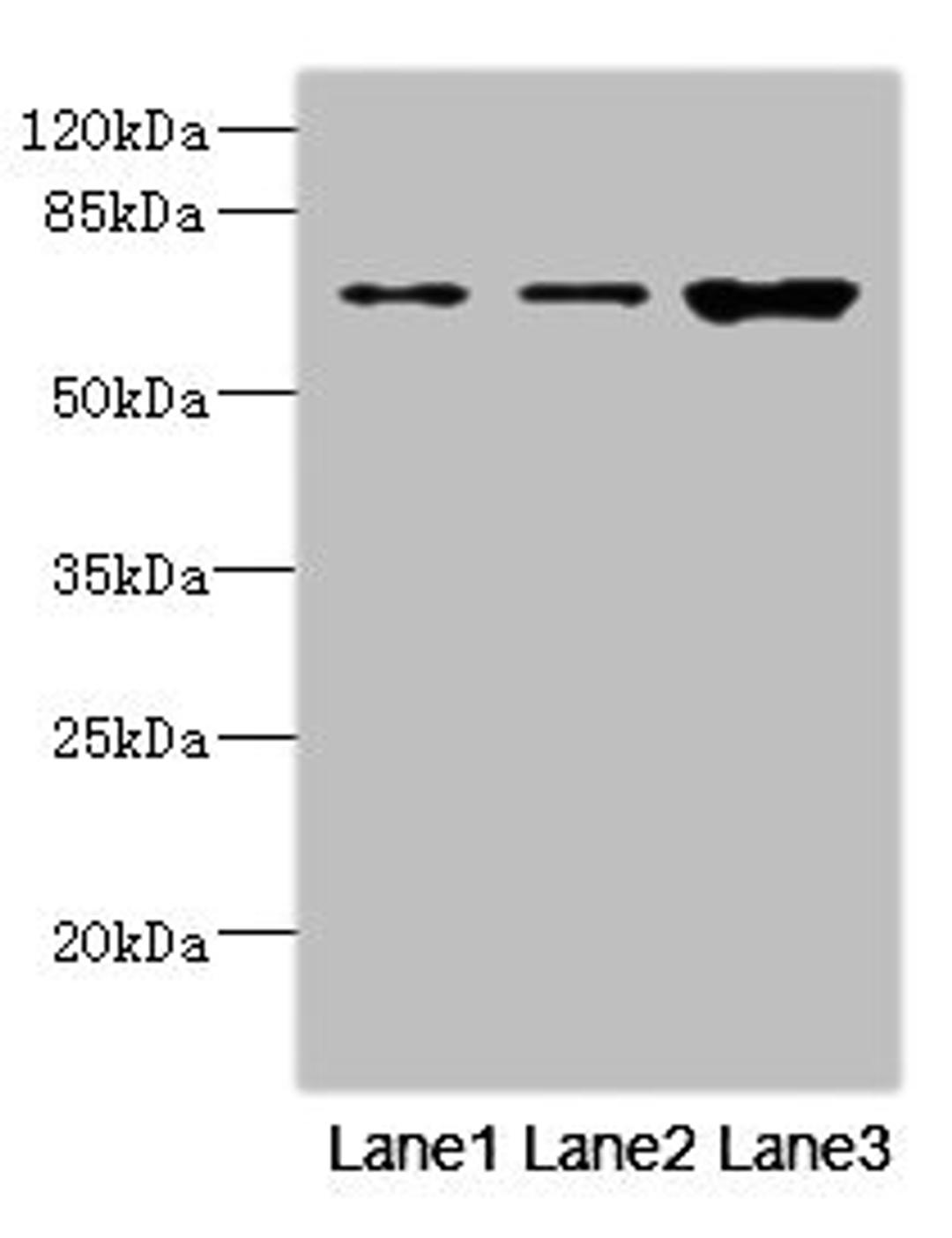 Western blot. All lanes: SNX18 antibody at 1.6µg/ml. Lane 1: A549 whole cell lysate. Lane 2: Hela whole cell lysate. Lane 3: Mouse kidney tissue. Secondary. Goat polyclonal to rabbit IgG at 1/10000 dilution. Predicted band size: 69, 70, 65 kDa. Observed band size: 69 kDa