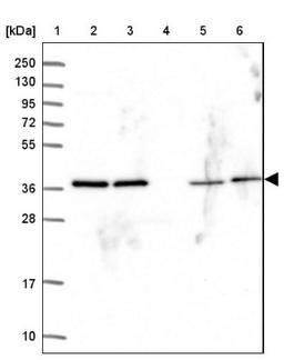 Western Blot: PSMD7 Antibody [NBP2-38612] - Lane 1: Marker [kDa] 250, 130, 95, 72, 55, 36, 28, 17, 10<br/>Lane 2: RT-4<br/>Lane 3: U-251 MG<br/>Lane 4: Human Plasma<br/>Lane 5: Liver<br/>Lane 6: Tonsil