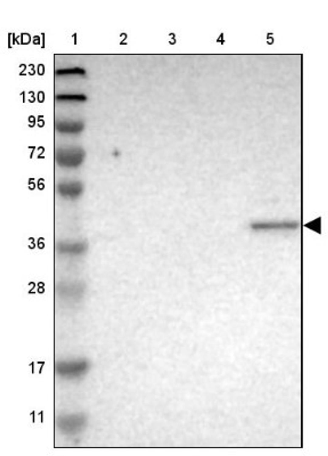 Western Blot: PRRT2 Antibody [NBP1-84168] - Lane 1: Marker [kDa] 230, 130, 95, 72, 56, 36, 28, 17, 11<br/>Lane 2: Human cell line RT-4<br/>Lane 3: Human cell line U-251MG sp<br/>Lane 4: Human plasma (IgG/HSA depleted)<br/>Lane 5: Human liver tissue