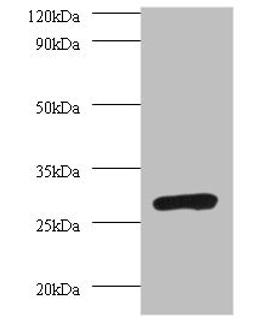 Western blot. All lanes: PSMA7 antibody at 2µg/ml + 293T whole cell lysate. Secondary. Goat polyclonal to rabbit IgG at 1/10000 dilution. Predicted band size: 28, 21, 17 kDa. Observed band size: 28 kDa