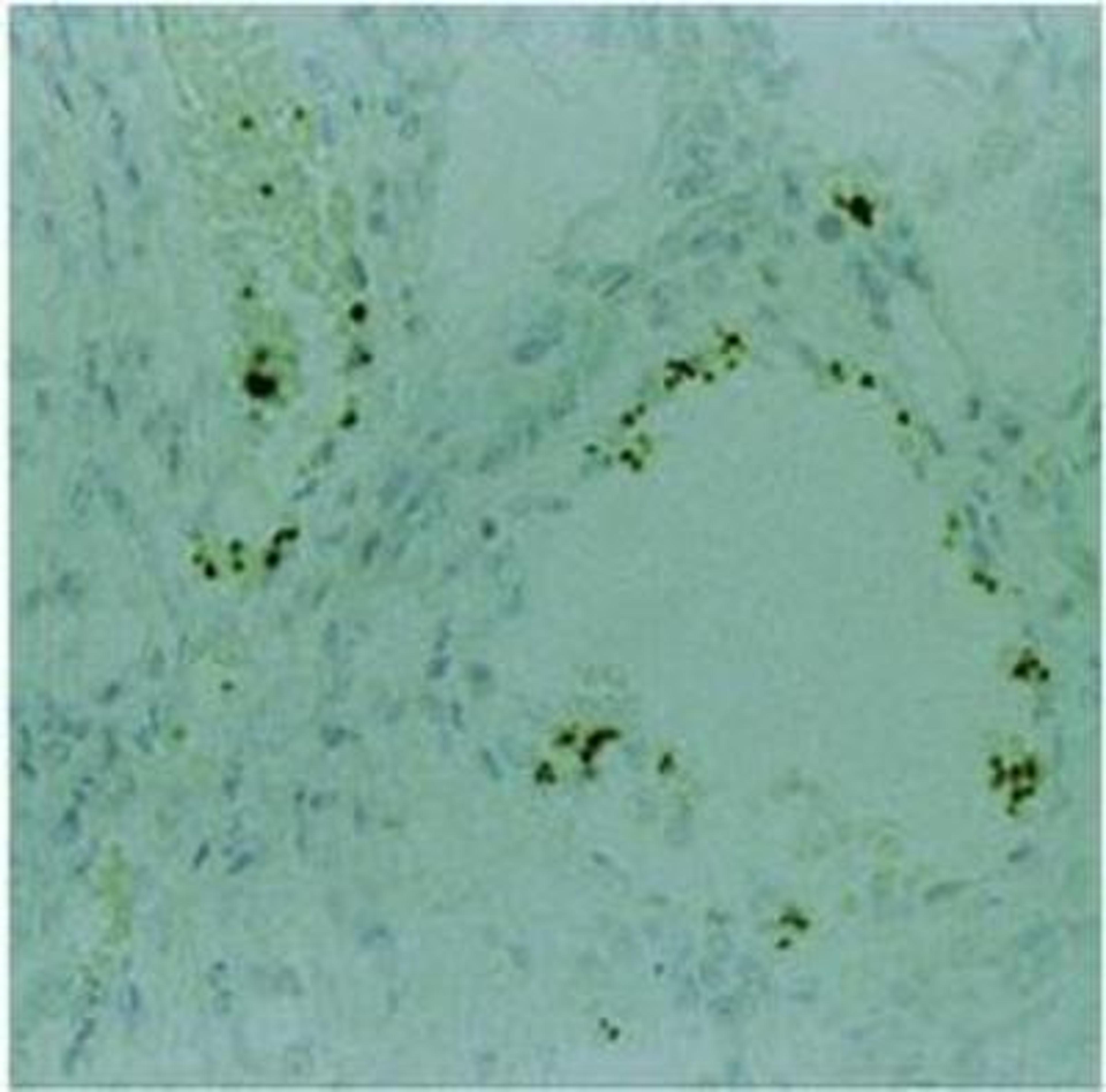 Immunohistochemistry-Paraffin: Thrombospondin Antibody (A6.1) [NB100-2059] - IHC analysis of Thrombospondin formalin-fixed paraffin embedded human tonsil using NB100-2059.