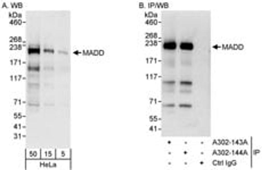 Detection of human MADD by western blot and immunoprecipitation.