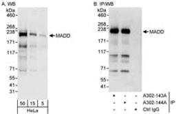 Detection of human MADD by western blot and immunoprecipitation.