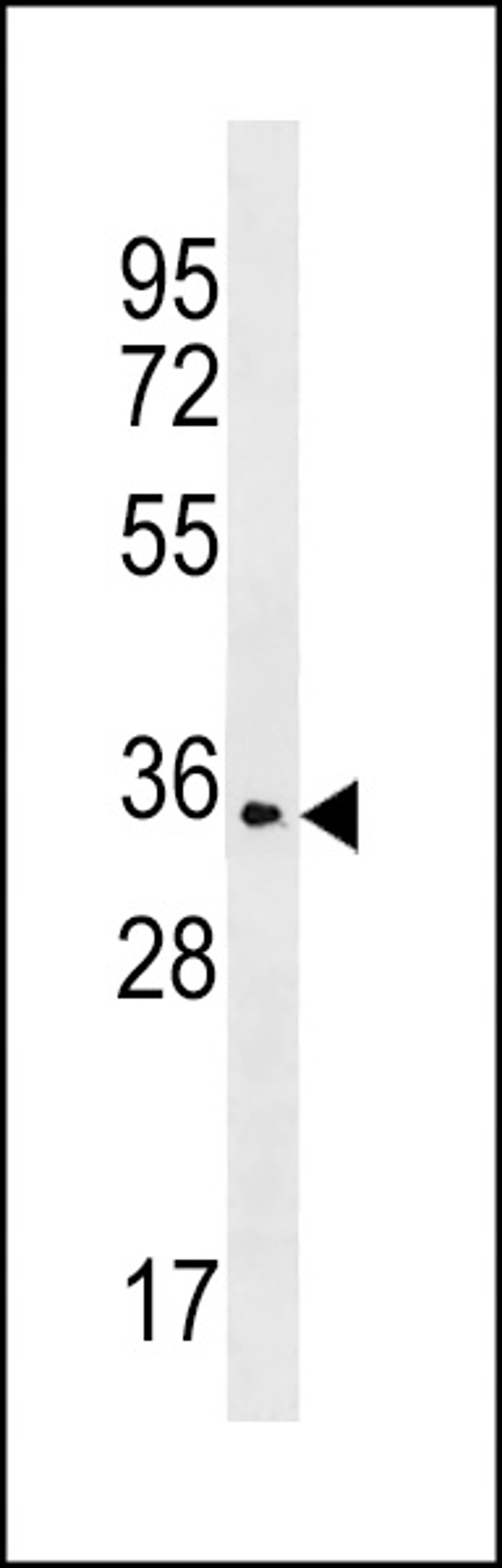 Western blot analysis in A2058 cell line lysates (35ug/lane).