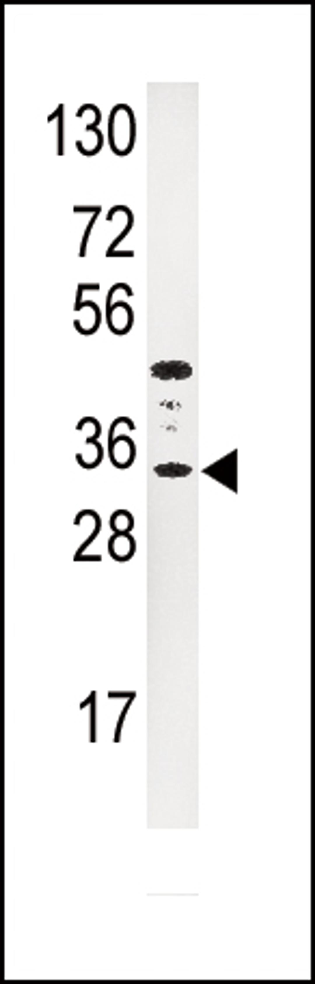 Western blot analysis of anti-IGFBP3 Antibody in HepG2 cell line lysates (35ug/lane).