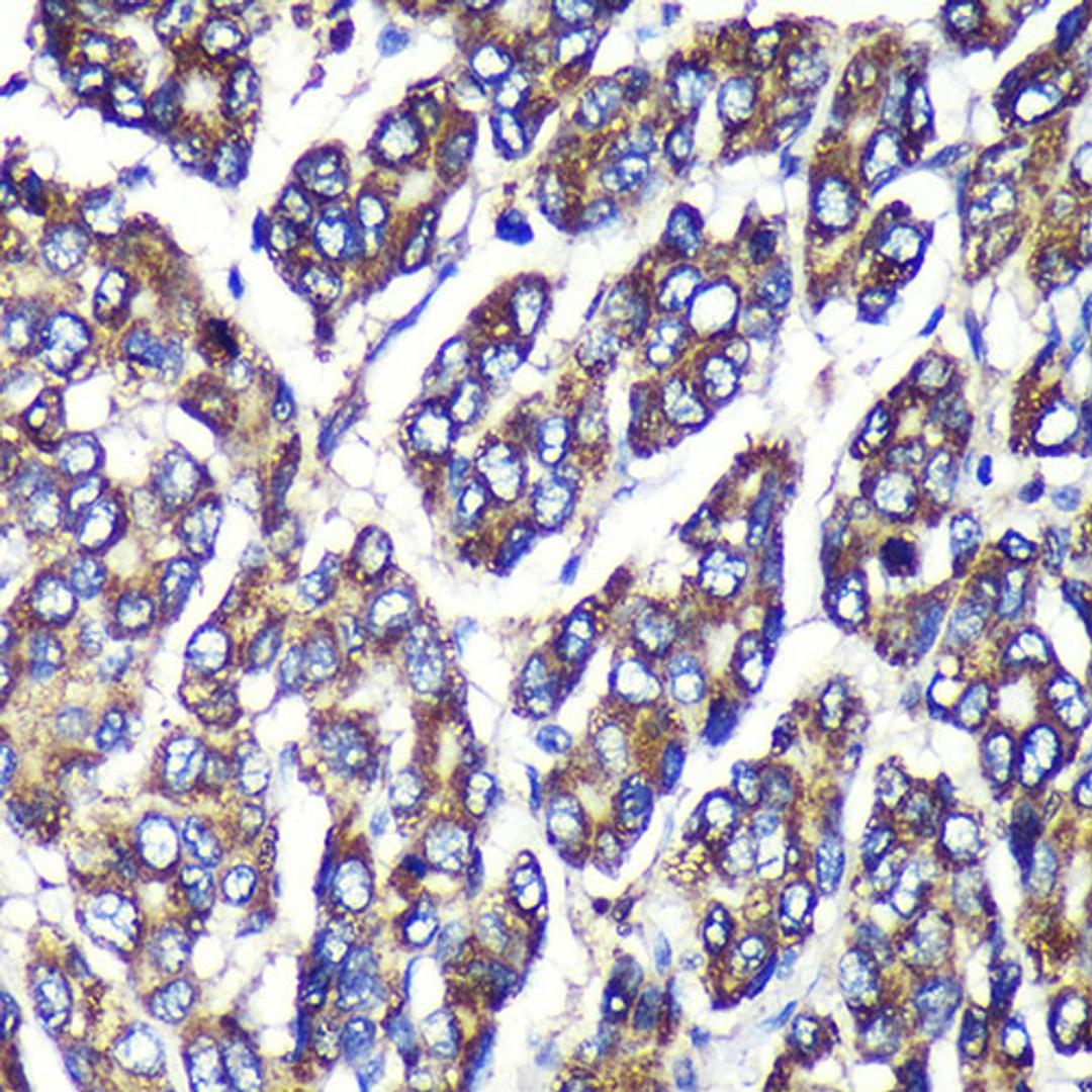 Immunohistochemistry  - UGT1A1 Rabbit pAb (A6186)