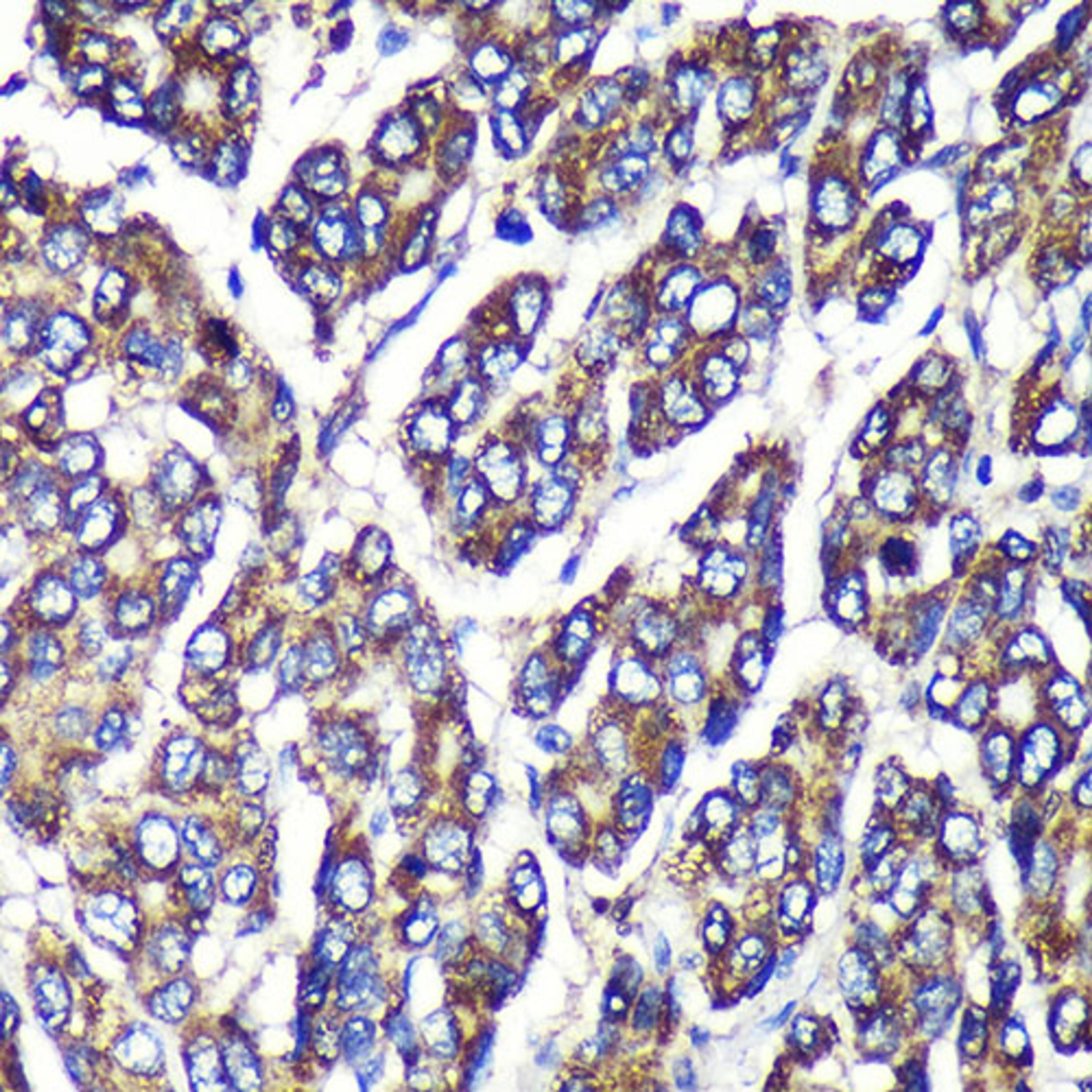 Immunohistochemistry - UGT1A1 Rabbit pAb (A6186)