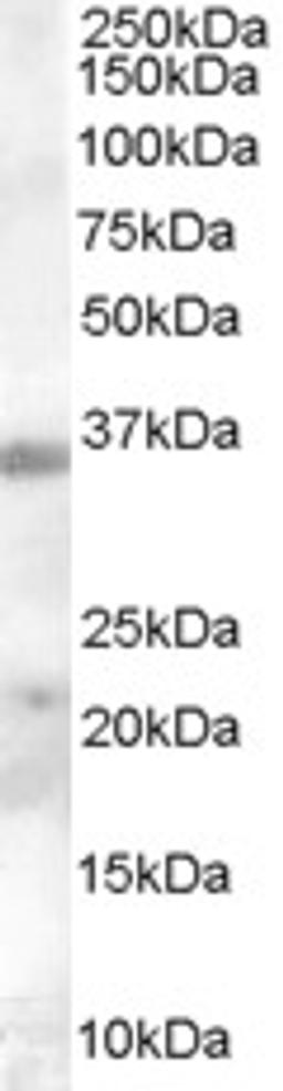 46-495 (0.3ug/ml) staining of Human Tonsil lysate (35ug protein in RIPA buffer). Primary incubation was 1 hour. Detected by chemiluminescence.