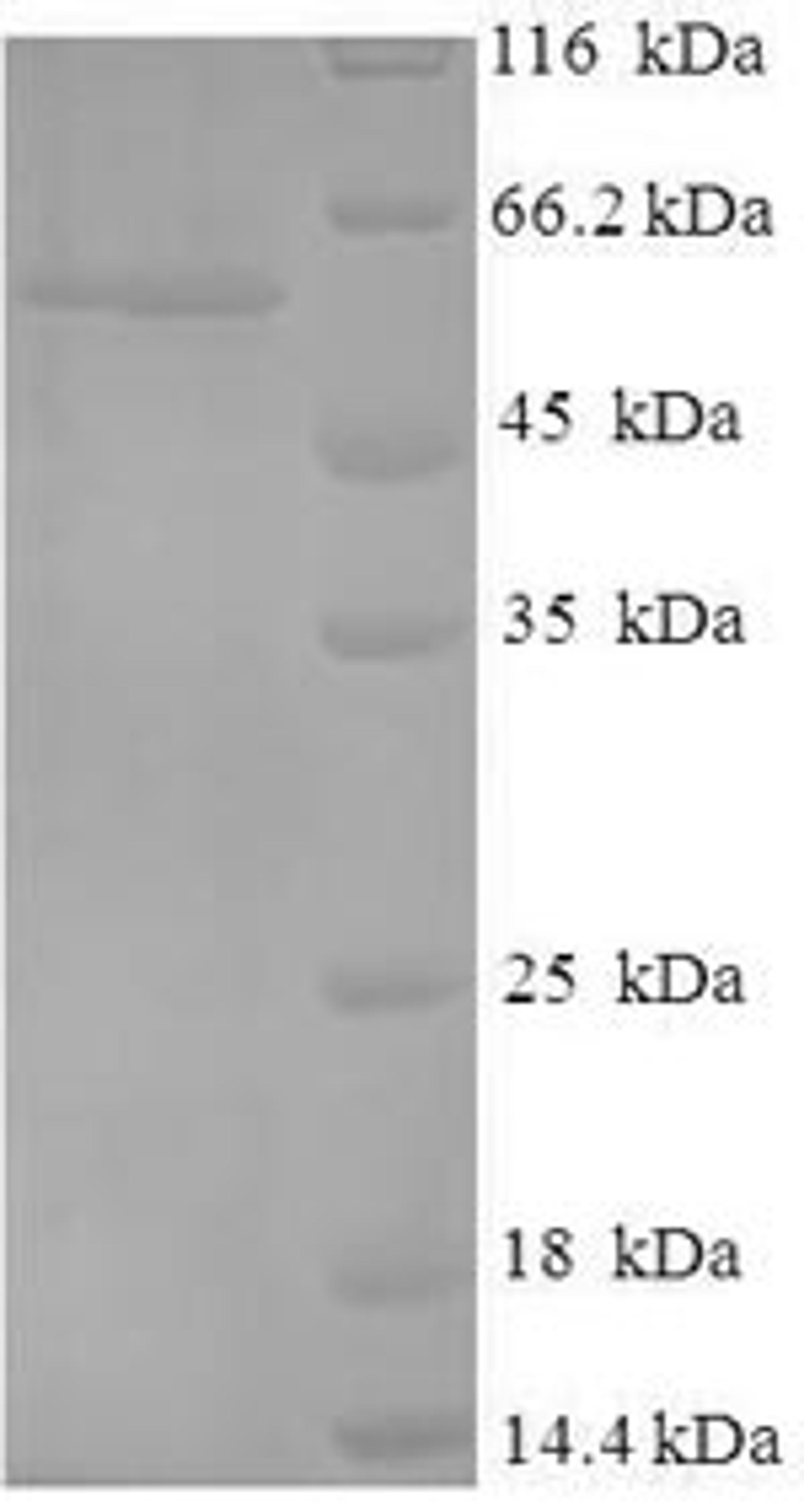 (Tris-Glycine gel) Discontinuous SDS-PAGE (reduced) with 5% enrichment gel and 15% separation gel.
