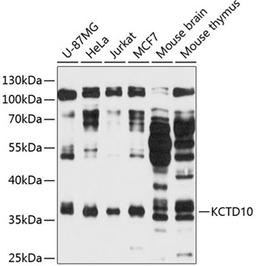 Western blot - KCTD10 antibody (A11941)