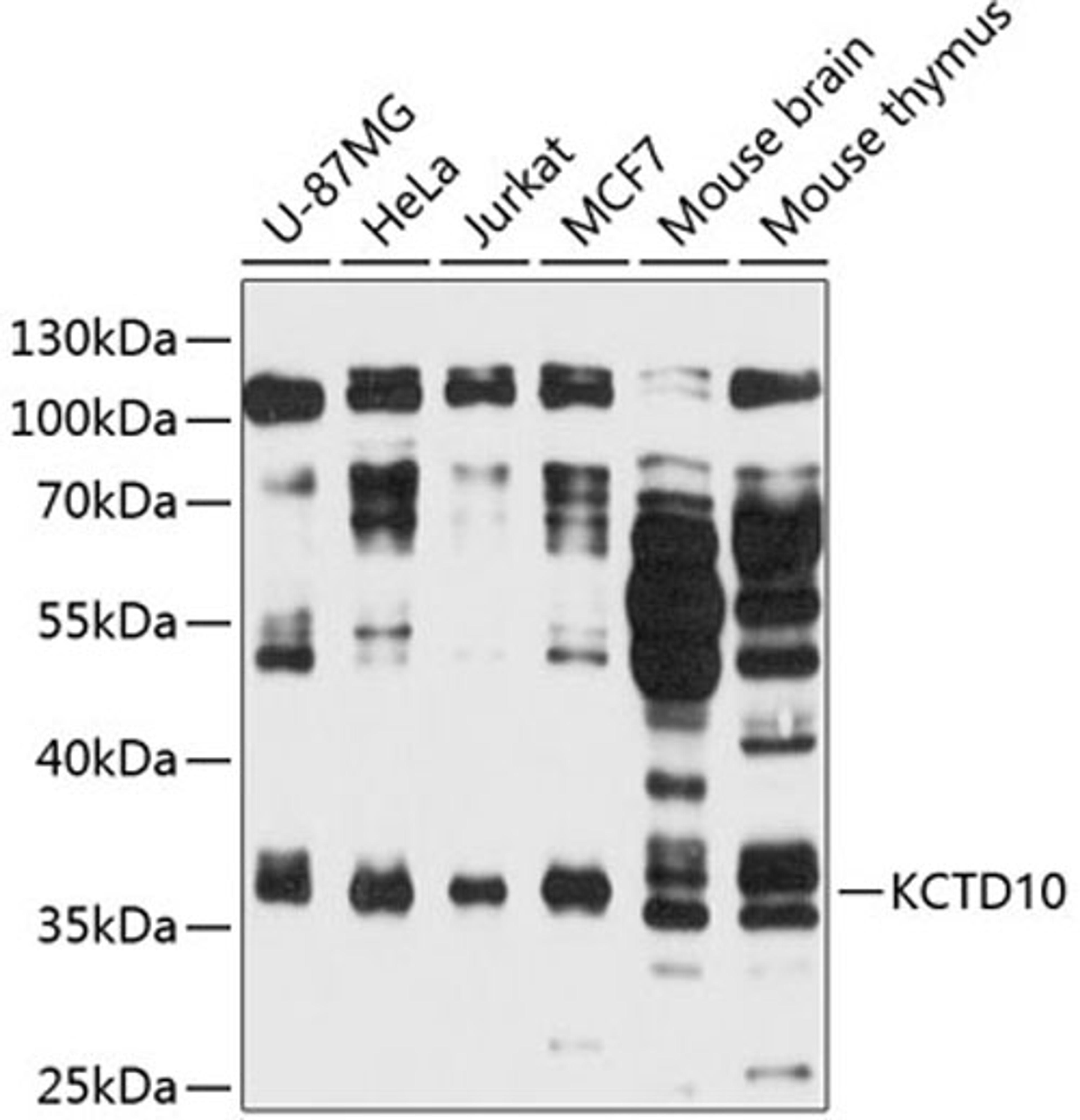 Western blot - KCTD10 antibody (A11941)