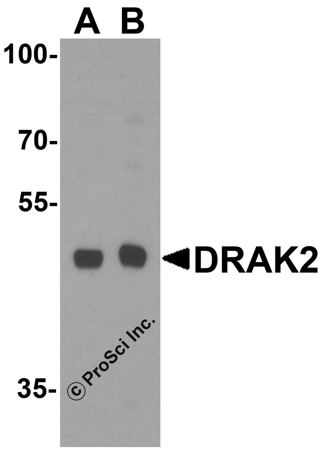 Western blot analysis of DRAK2 in Raji cell lysate with DRAK2 antibody at (A) 1 and B (2) μg/mL.
