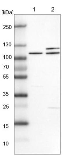 Western Blot: EXOC2 Antibody [NBP1-83785] - Lane 1: NIH-3T3 cell lysate (Mouse embryonic fibroblast cells)<br/>Lane 2: NBT-II cell lysate (Rat Wistar bladder tumour cells)