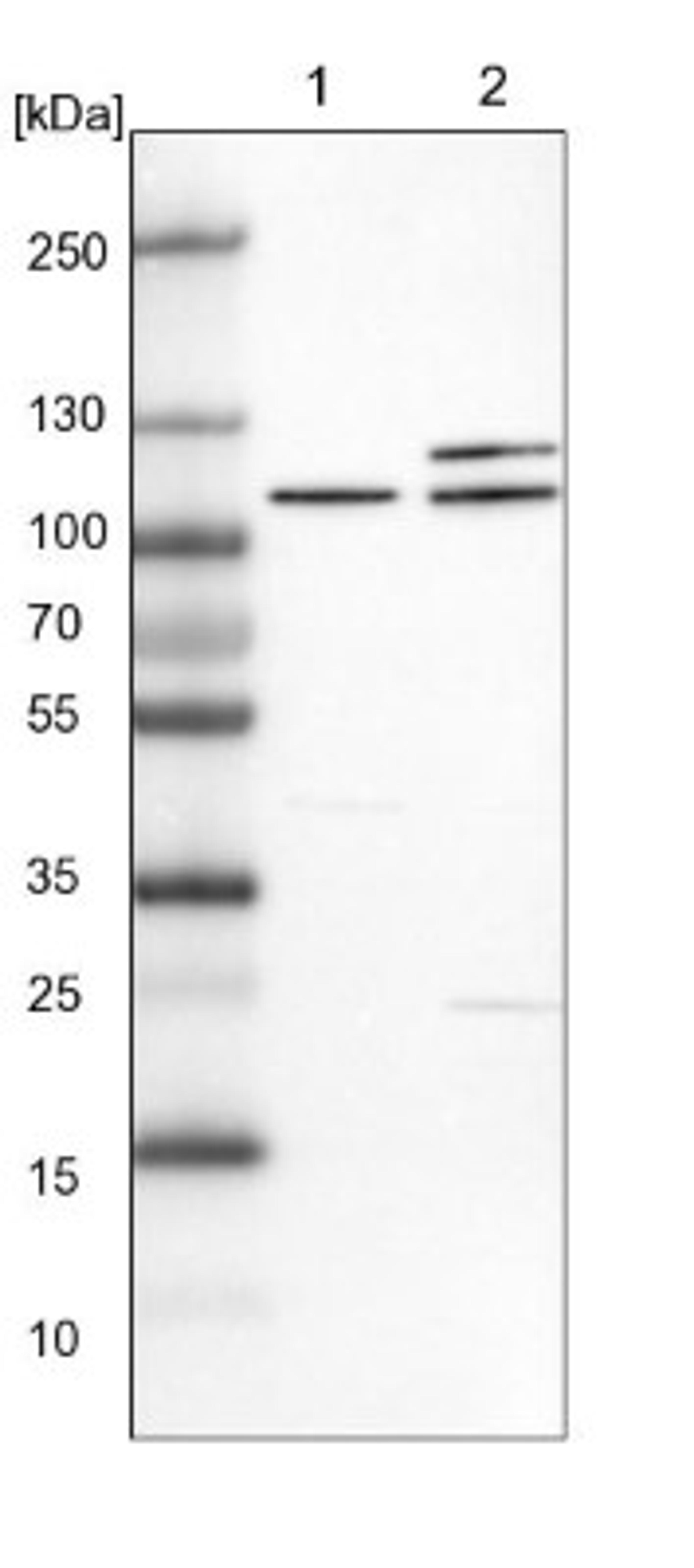 Western Blot: EXOC2 Antibody [NBP1-83785] - Lane 1: NIH-3T3 cell lysate (Mouse embryonic fibroblast cells)<br/>Lane 2: NBT-II cell lysate (Rat Wistar bladder tumour cells)