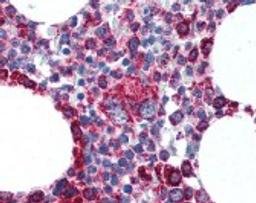 Immunohistochemistry staining of Somatic Cytochrome C in human bone marrow tissue using Somatic Cytochrome C Monoclonal Antibody.