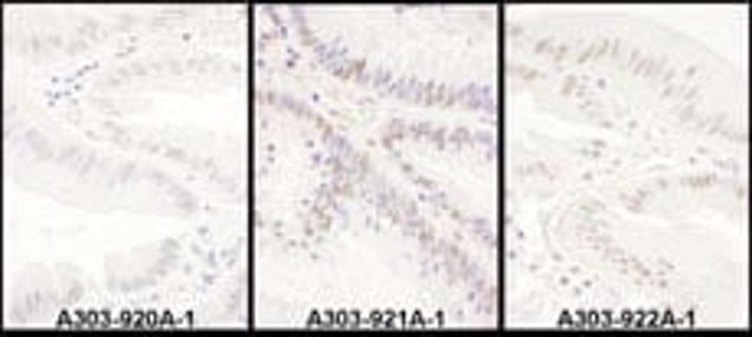 Detection of human PRPF8 by immunohistochemistry.