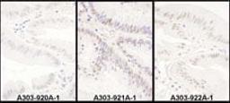 Detection of human PRPF8 by immunohistochemistry.