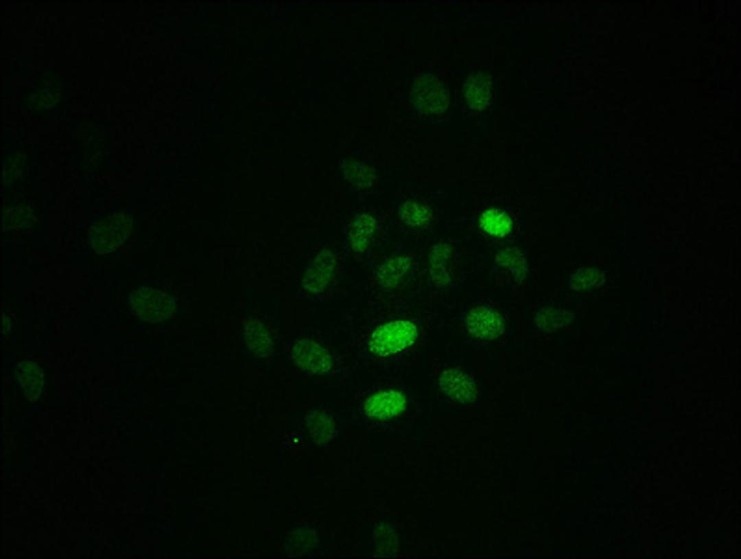 Immunofluorescence staining of Hela cells with CSB-RA020089A21phHU at 1:100,counter-stained with DAPI. The cells were fixed in 4% formaldehyde, permeabilized using 0.2% Triton X-100 and blocked in 10% normal Goat Serum. The cells were then incubated with the antibody overnight at 4℃. The secondary antibody was Alexa Fluor 488-congugated AffiniPure Goat Anti-Rabbit IgG (H+L).