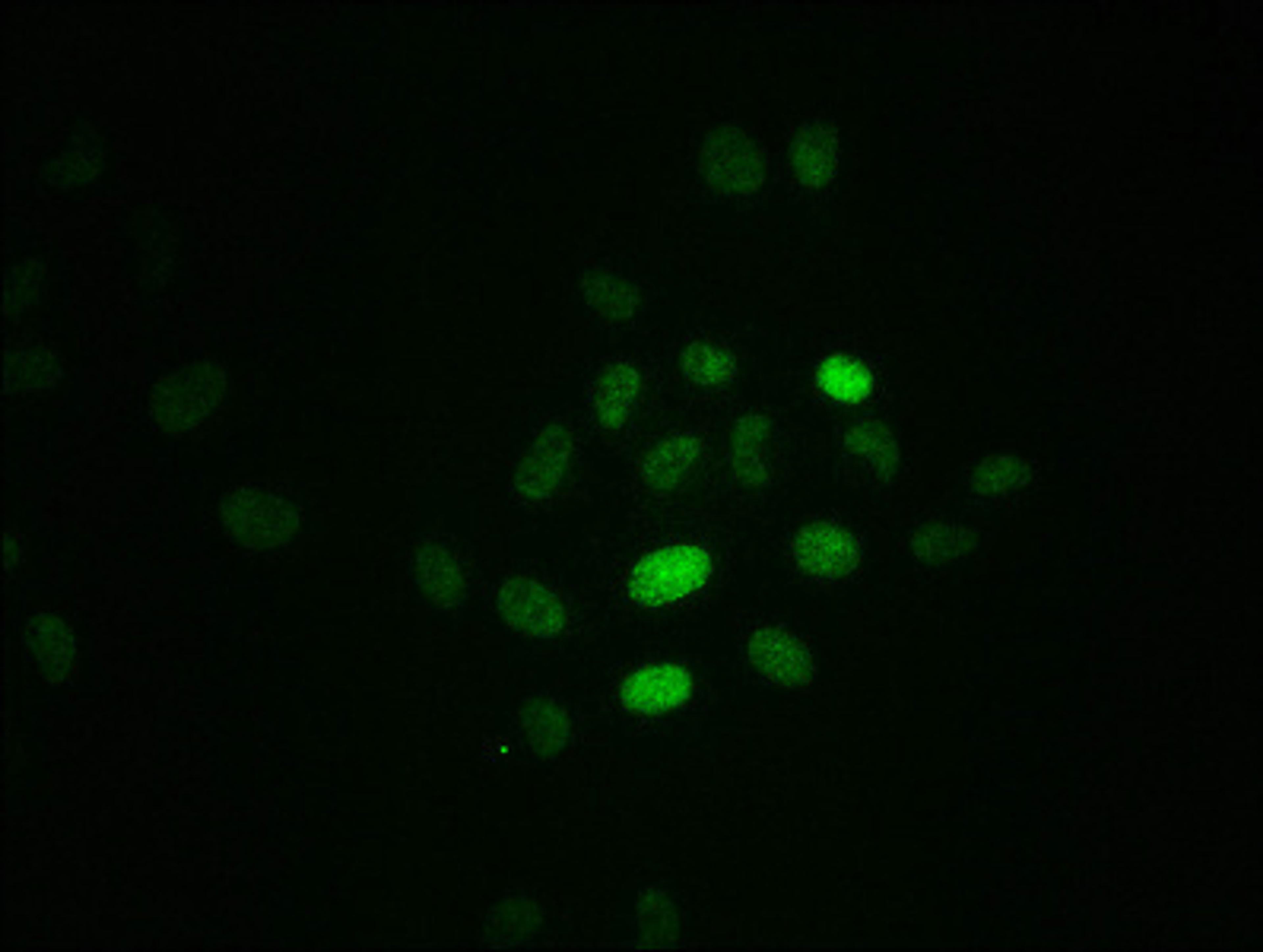 Immunofluorescence staining of Hela cells with CSB-RA020089A21phHU at 1:100,counter-stained with DAPI. The cells were fixed in 4% formaldehyde, permeabilized using 0.2% Triton X-100 and blocked in 10% normal Goat Serum. The cells were then incubated with the antibody overnight at 4℃. The secondary antibody was Alexa Fluor 488-congugated AffiniPure Goat Anti-Rabbit IgG (H+L).