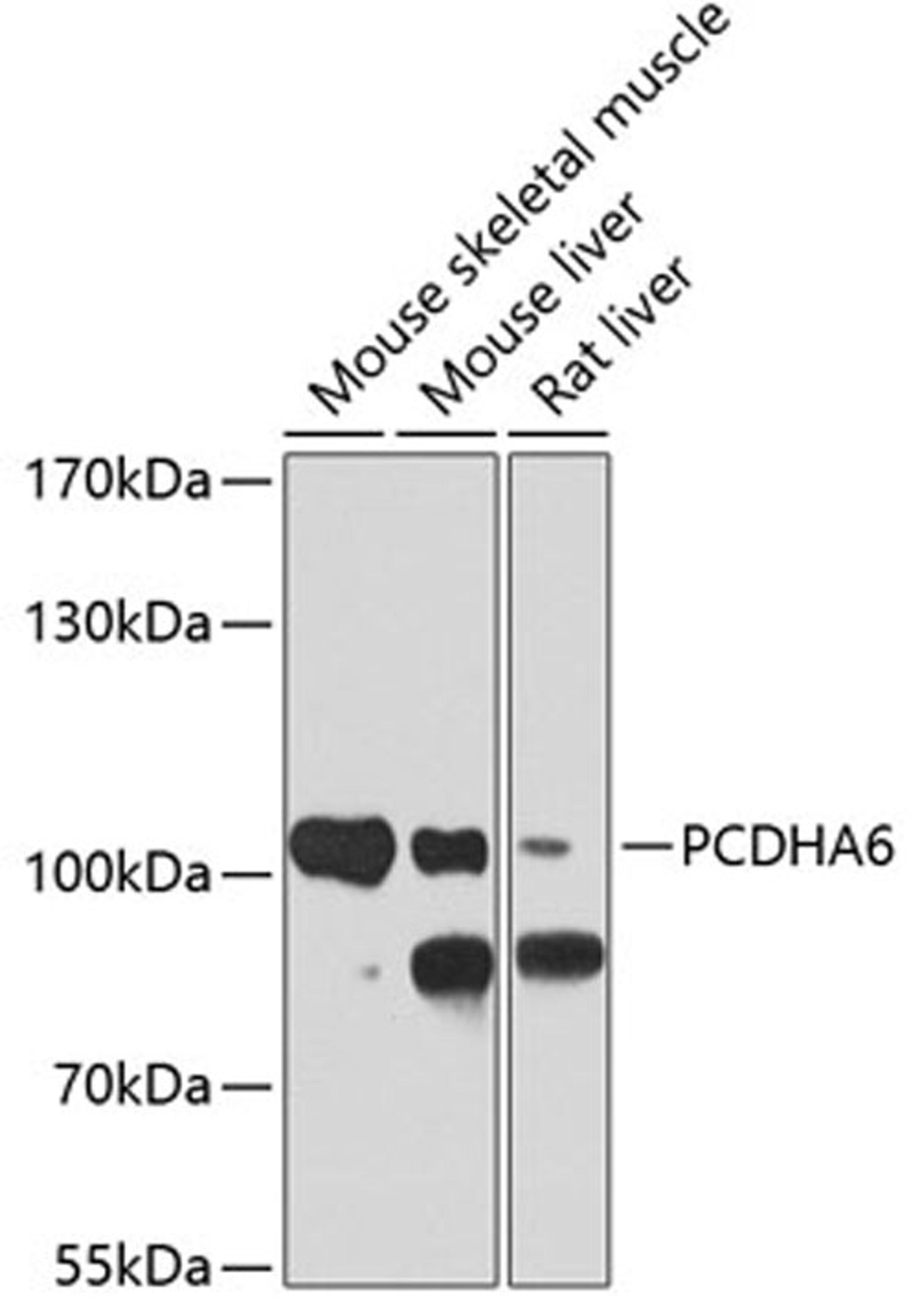 Western blot - PCDHA6 antibody (A4856)