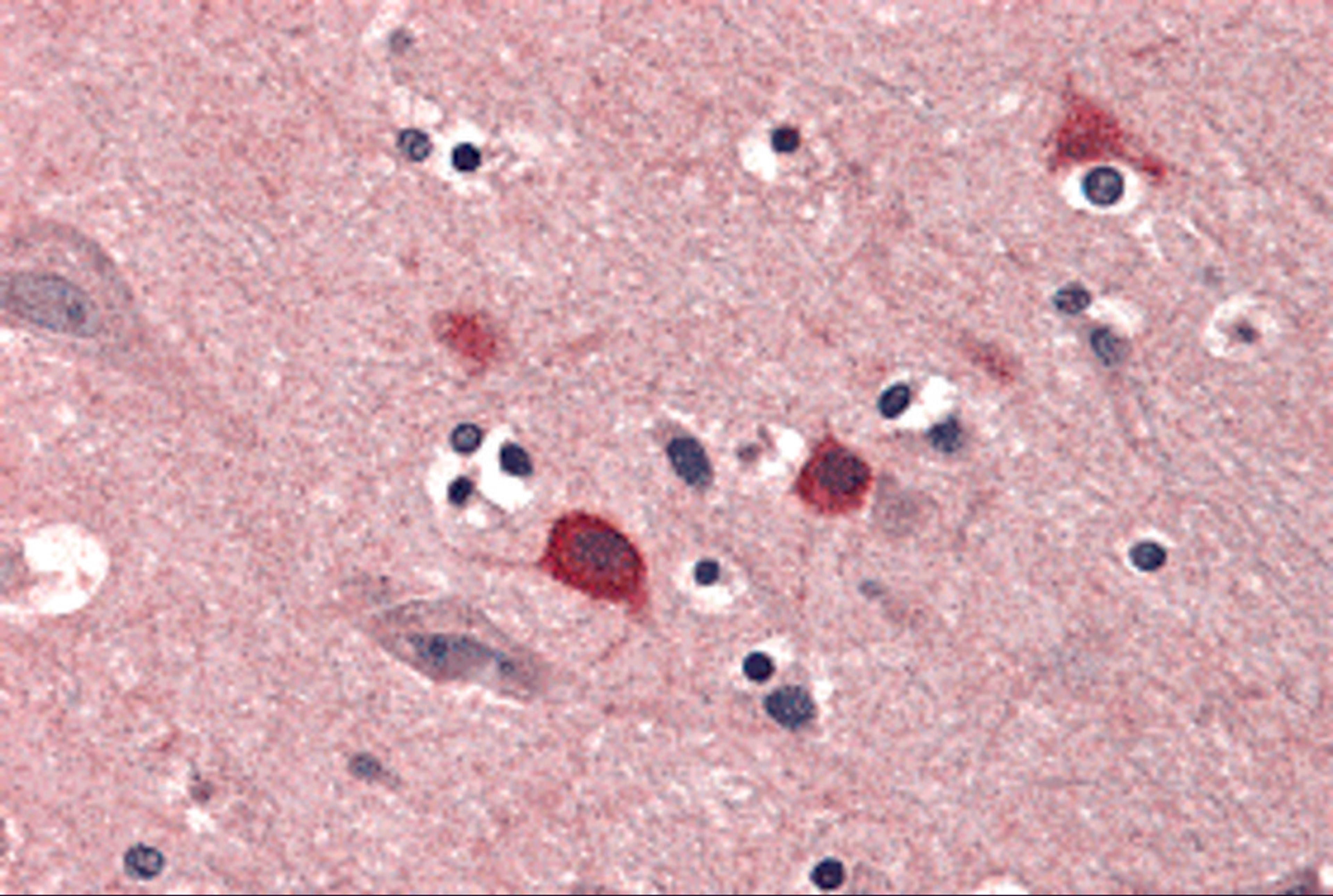 Immunohistochemistry of BOK in human brain tissue with BOK antibody at 5 &#956;g/mL.