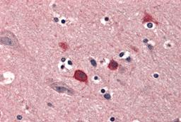 Immunohistochemistry of BOK in human brain tissue with BOK antibody at 5 μg/mL.
