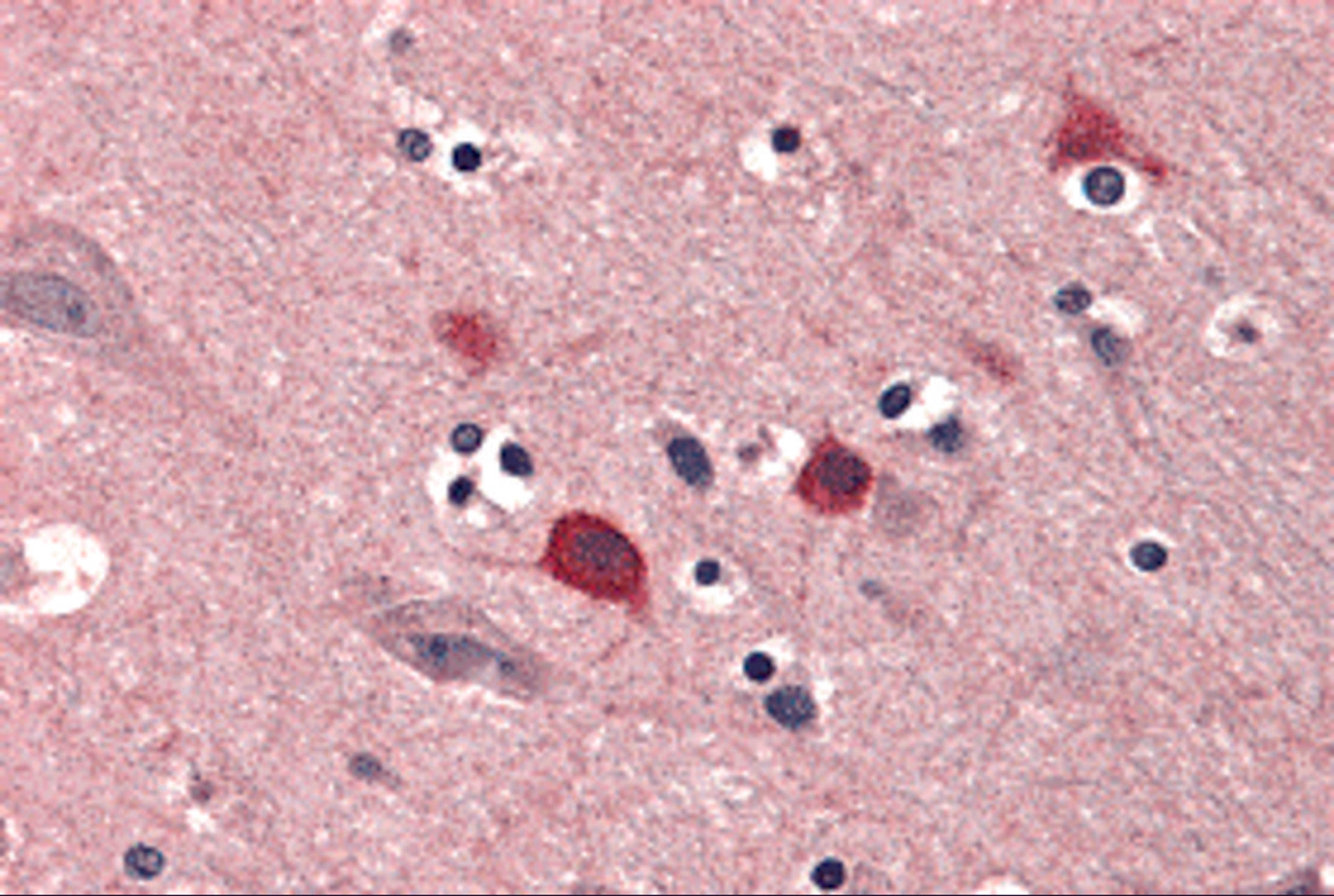 Immunohistochemistry of BOK in human brain tissue with BOK antibody at 5 μg/mL.