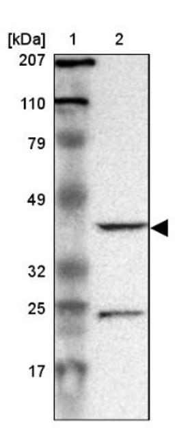 Western Blot: DRG1 Antibody [NBP1-82591] - Lane 1: Marker [kDa] 207, 110, 79, 49, 32, 25, 17<br/>Lane 2: Human cell line RT-4