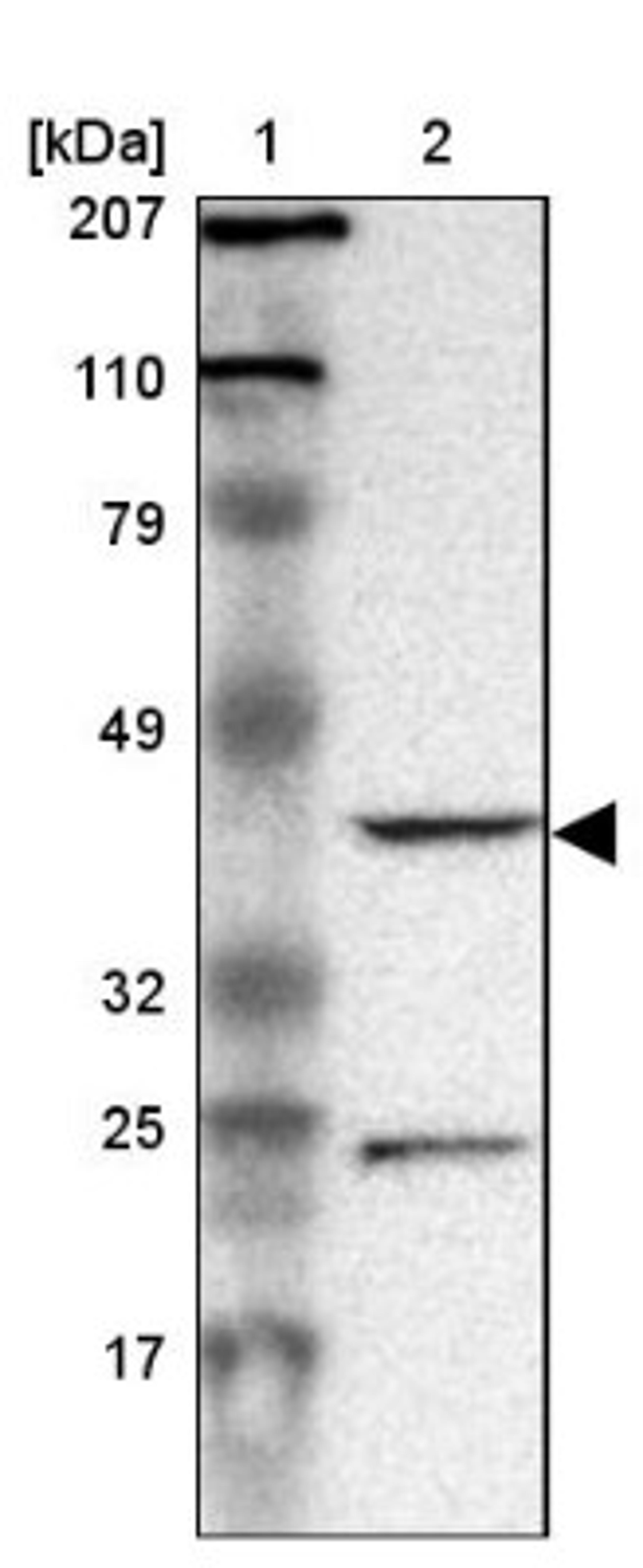 Western Blot: DRG1 Antibody [NBP1-82591] - Lane 1: Marker [kDa] 207, 110, 79, 49, 32, 25, 17<br/>Lane 2: Human cell line RT-4