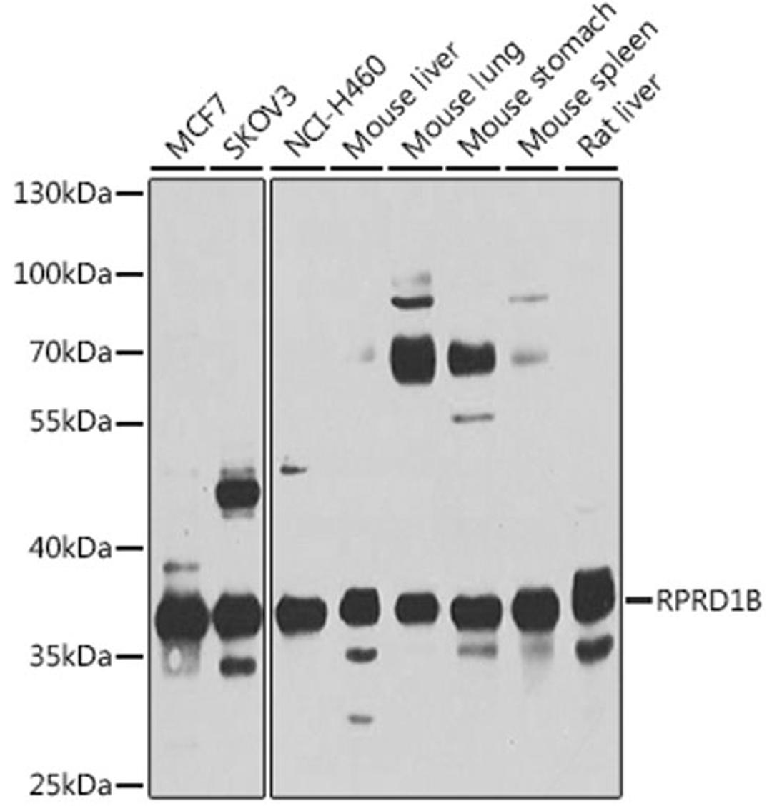 Western blot - rprd1b antibody (A10102)