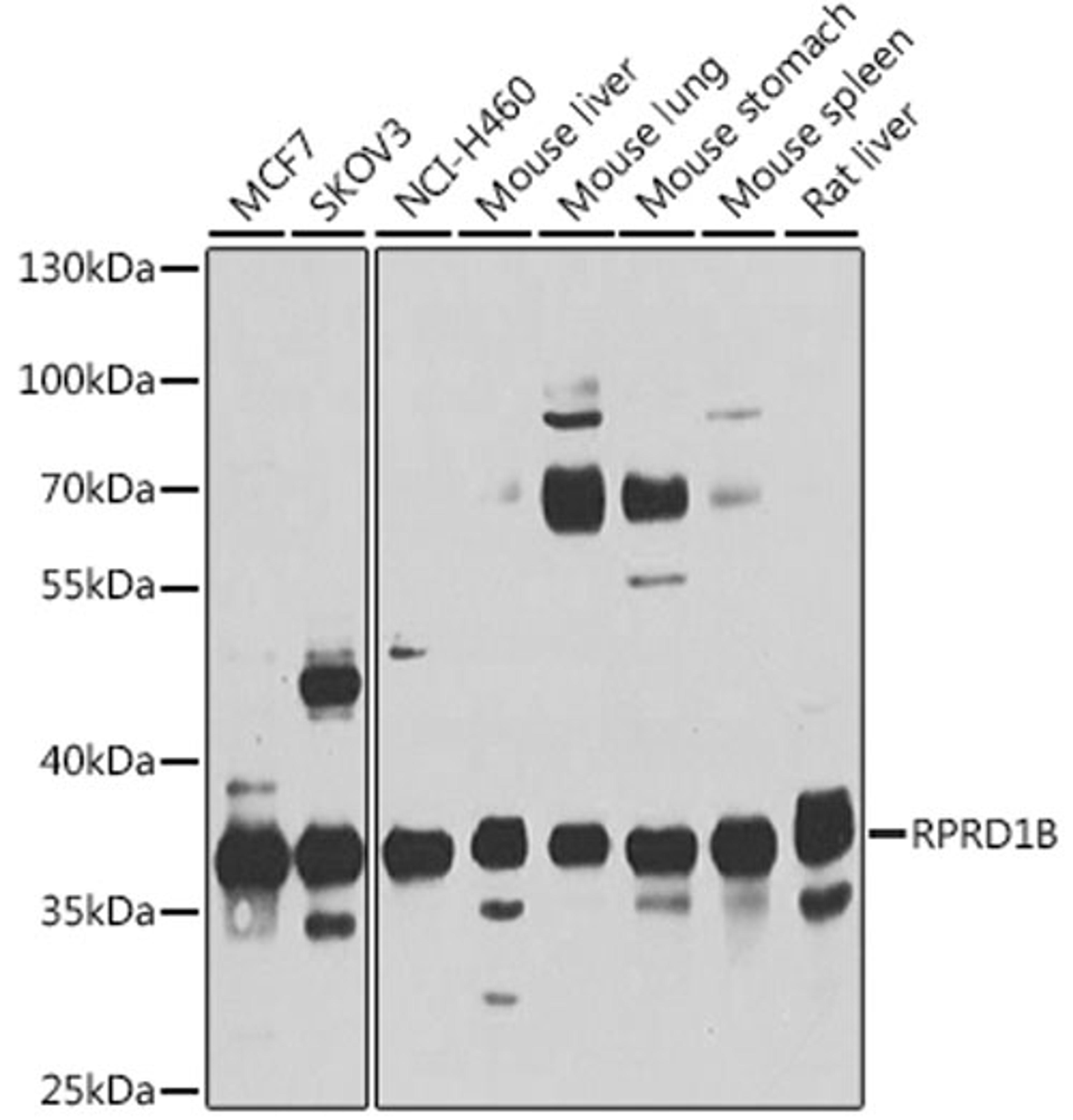 Western blot - rprd1b antibody (A10102)