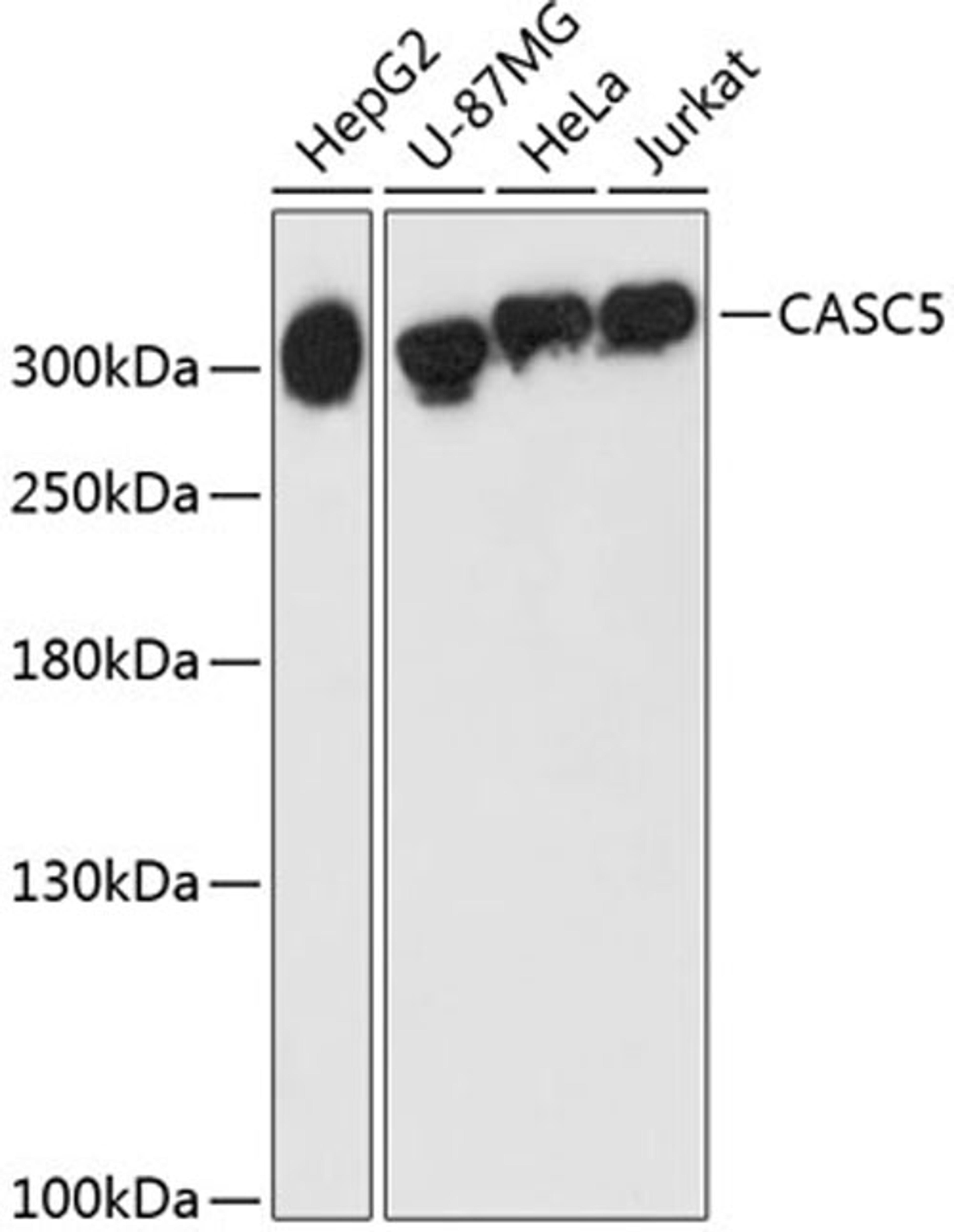 Western blot - CASC5 antibody (A13108)