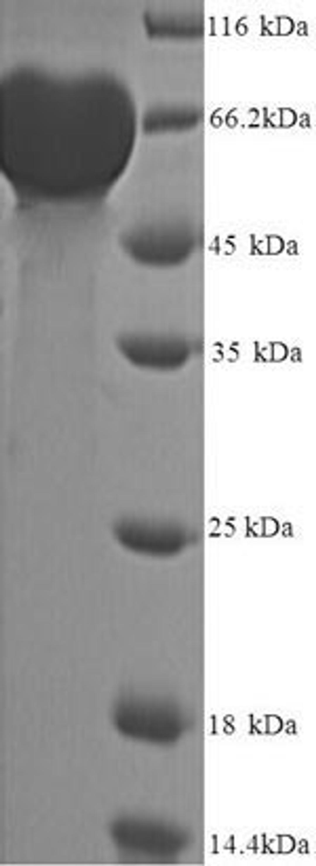 (Tris-Glycine gel) Discontinuous SDS-PAGE (reduced) with 5% enrichment gel and 15% separation gel.