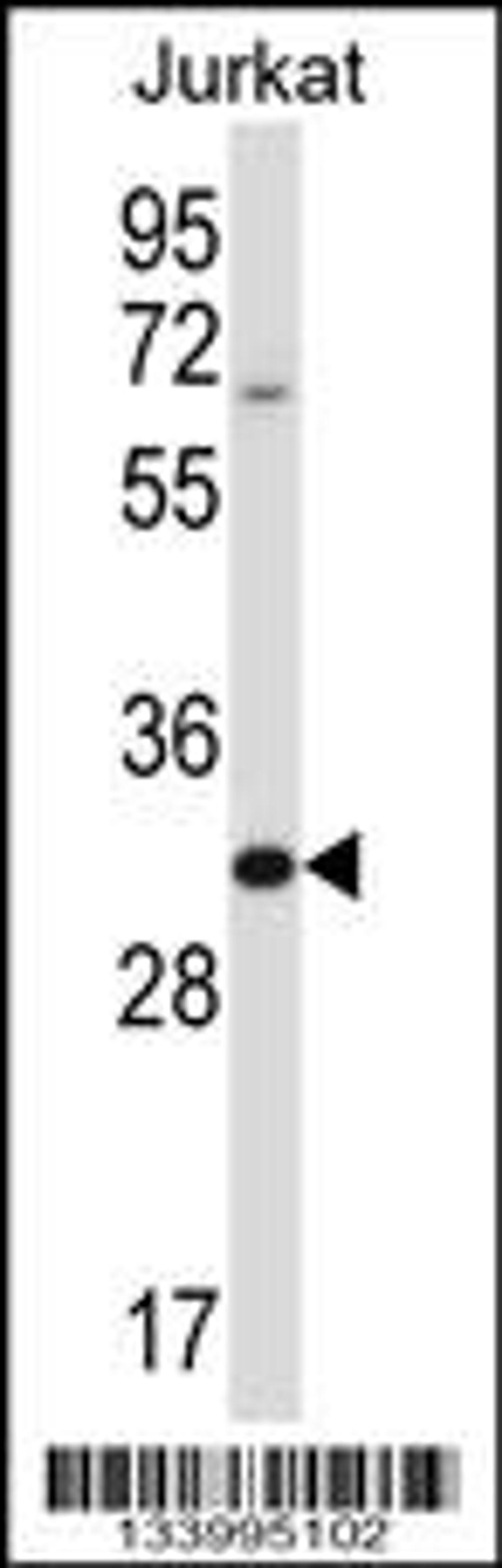 Western blot analysis in Jurkat cell line lysates (35ug/lane).