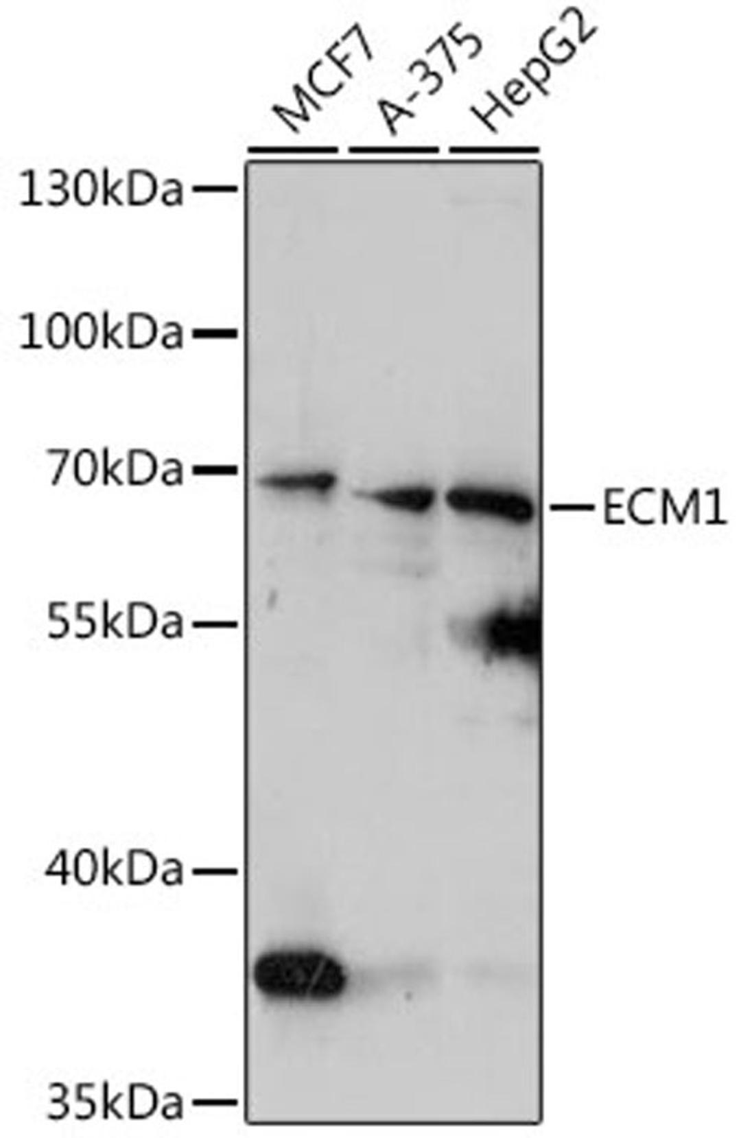 Western blot - ECM1 antibody (A16368)