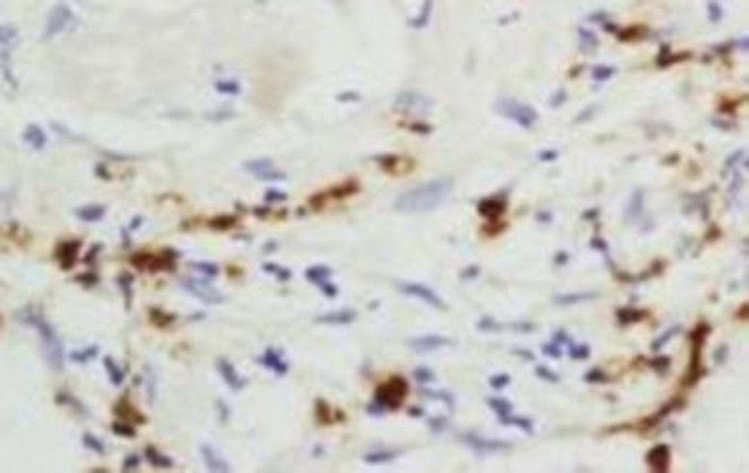 Immunohistochemical analysis of formalin-fixed paraffin embedded mouse cancer tissue using PEG10 antibody (dilution at 1:200)