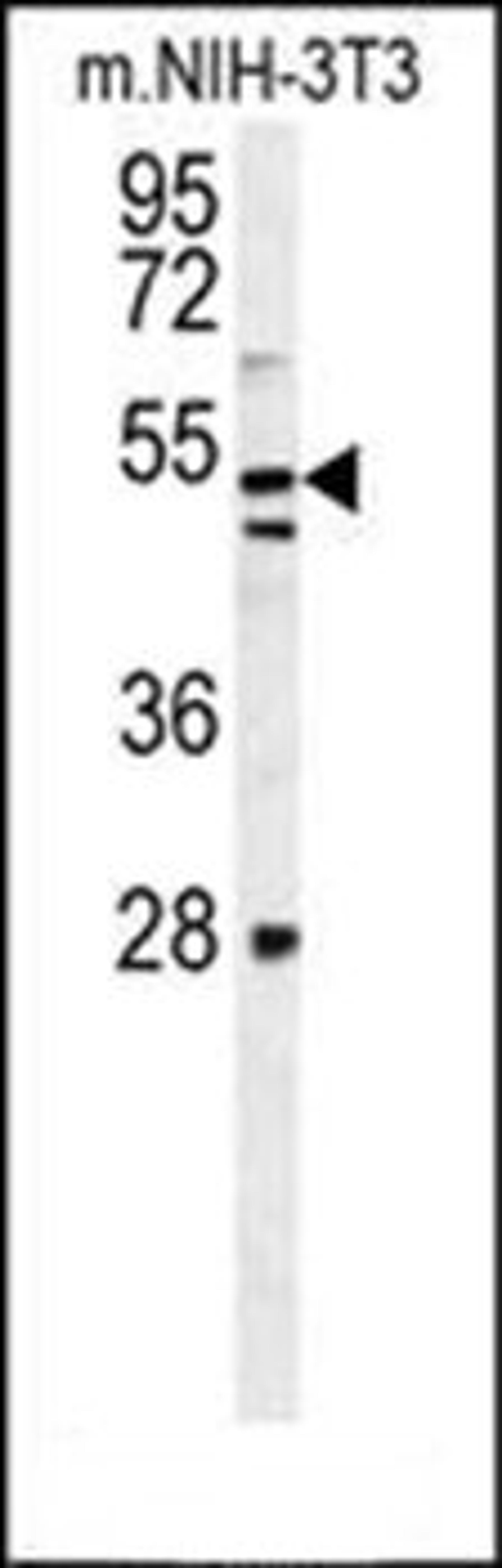 Western blot analysis of mouse NIH-3T3 cell line lysates (35ug/lane) using K1609 antibody (C-term)