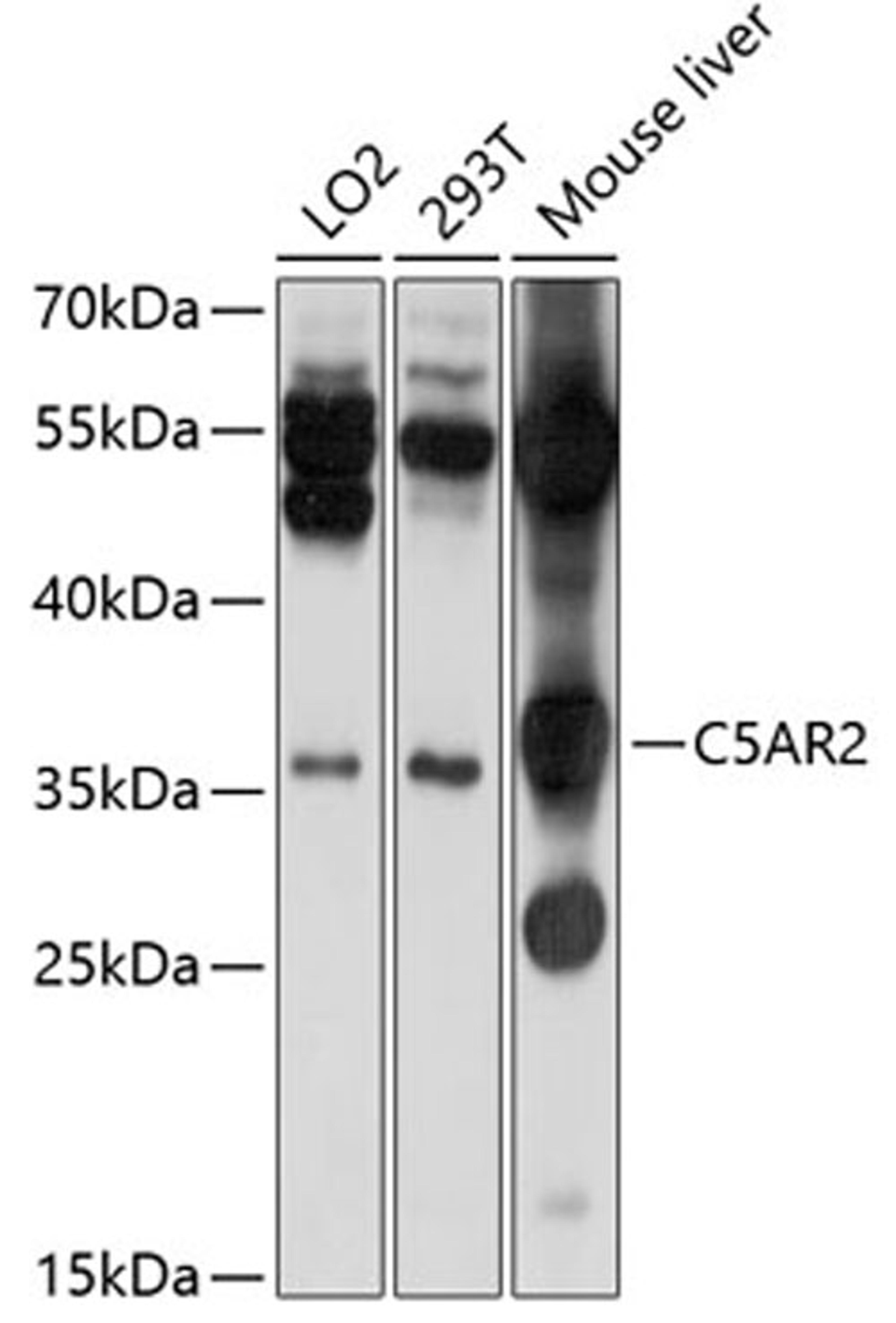 Western blot - C5AR2 antibody (A10588)