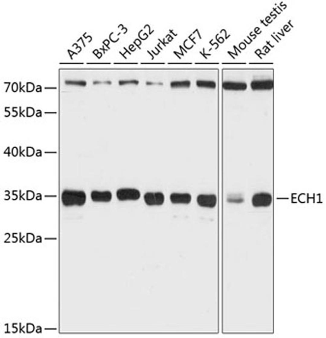 Western blot - ECH1 Antibody (A12944)