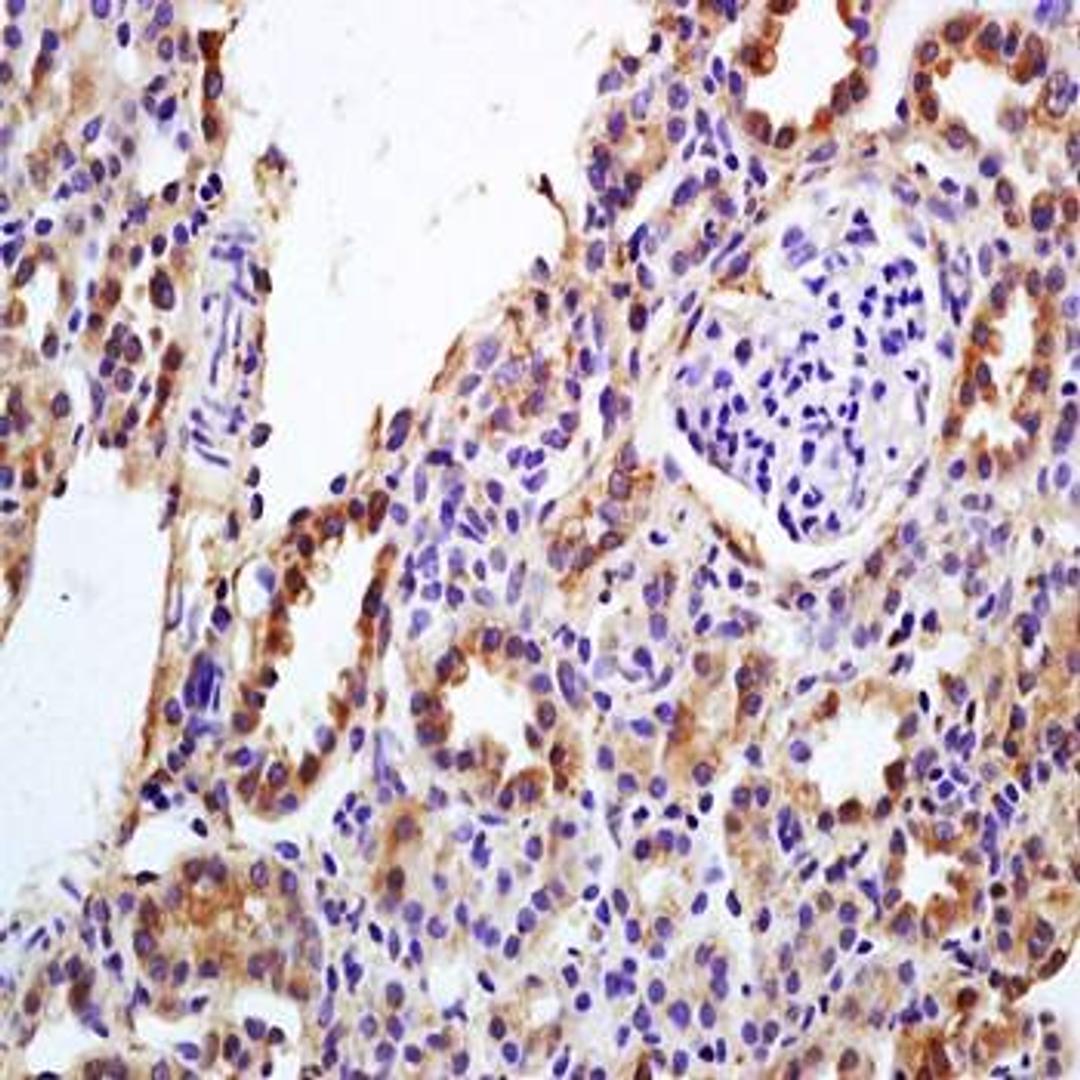 Immunohistochemical analysis of rat kidney tissue using DMT1 antibody