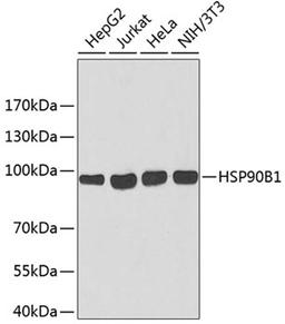 Western blot - HSP90B1 antibody (A6272)