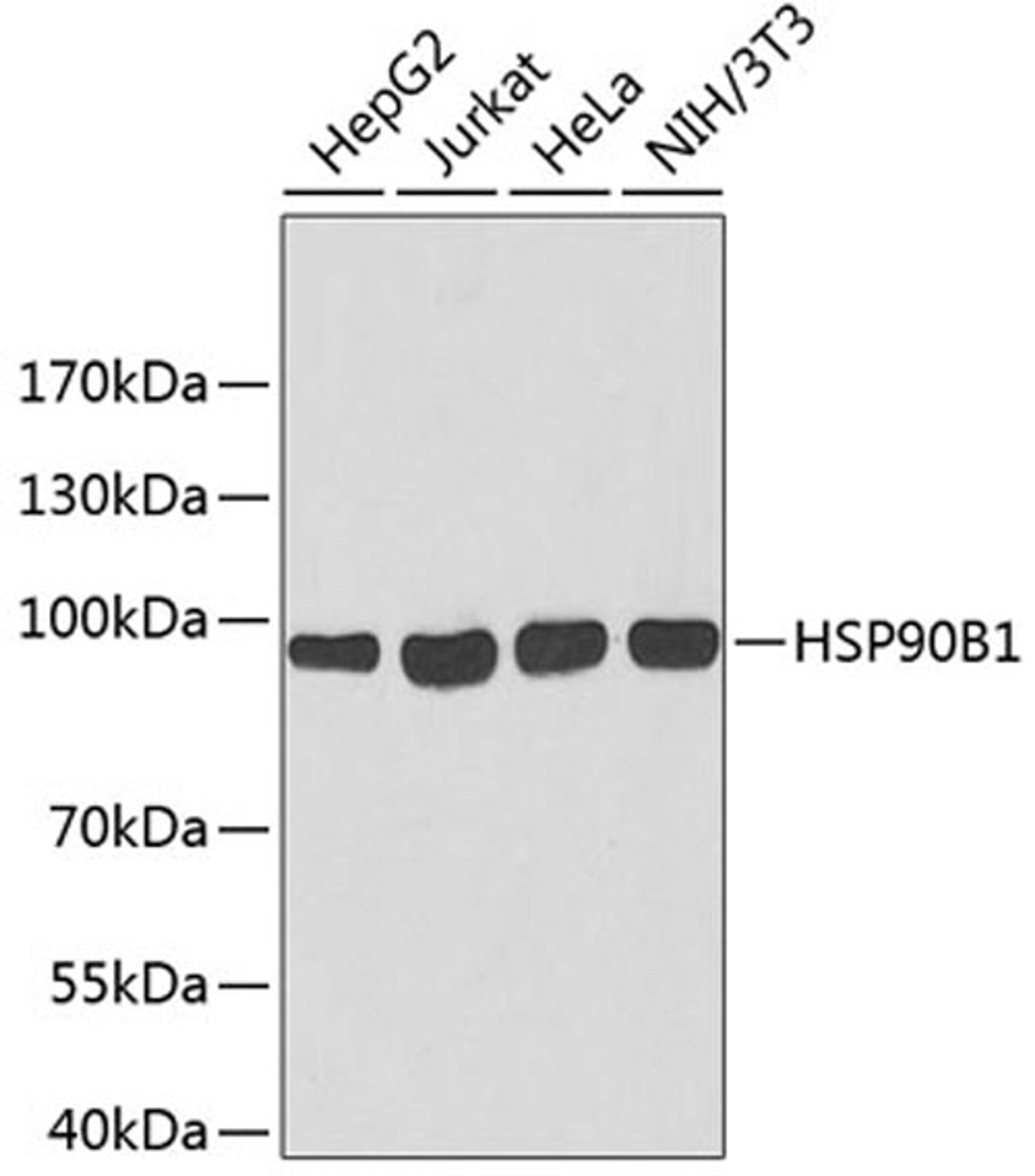 Western blot - HSP90B1 antibody (A6272)