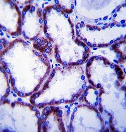 Immunohistochemical analysis of formalin fixed and paraffin embedded human kidney tissue using SLC22A1 antibody 