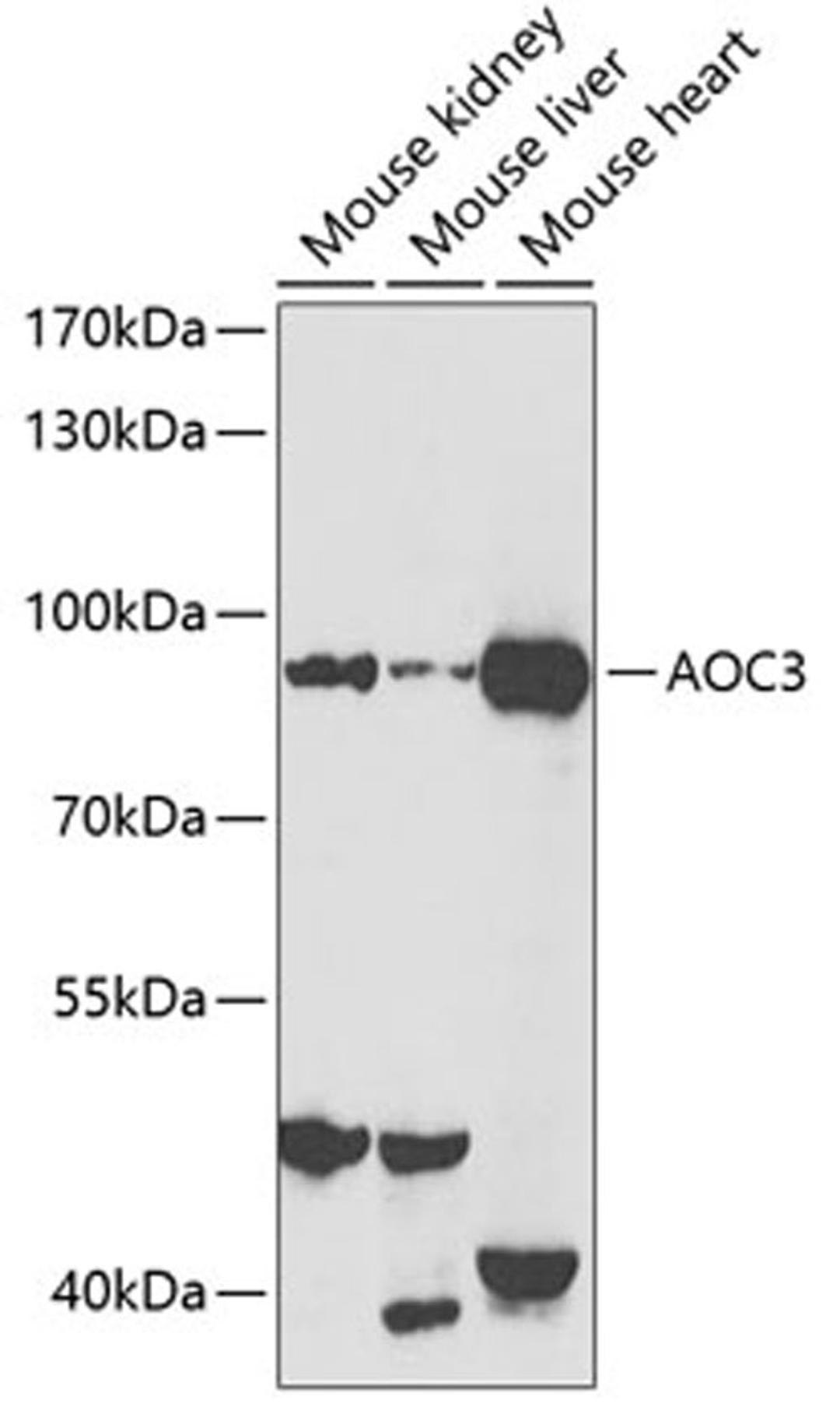 Western blot - AOC3 antibody (A2001)