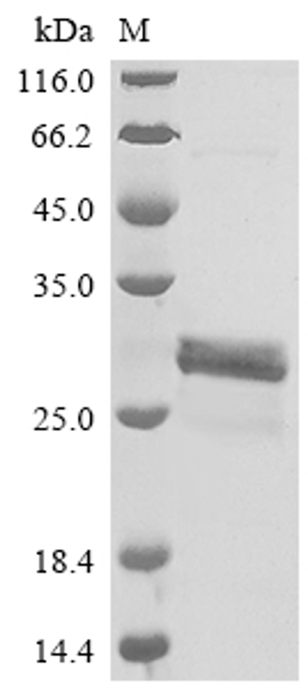 (Tris-Glycine gel) Discontinuous SDS-PAGE (reduced) with 5% enrichment gel and 15% separation gel.