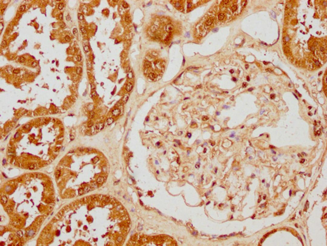 IHC image of CSB-PA010429PA31nforHU diluted at 1:40 and staining in paraffin-embedded human kidney tissue performed on a Leica BondTM system. After dewaxing and hydration, antigen retrieval was mediated by high pressure in a citrate buffer (pH 6.0). Section was blocked with 10% normal goat serum 30min at RT. Then primary antibody (1% BSA) was incubated at 4°C overnight. The primary is detected by a biotinylated secondary antibody and visualized using an HRP conjugated SP system.